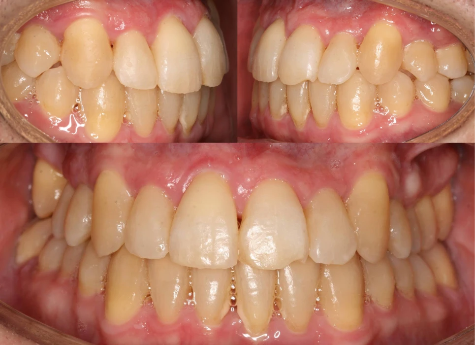 After image