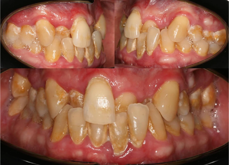 Before image