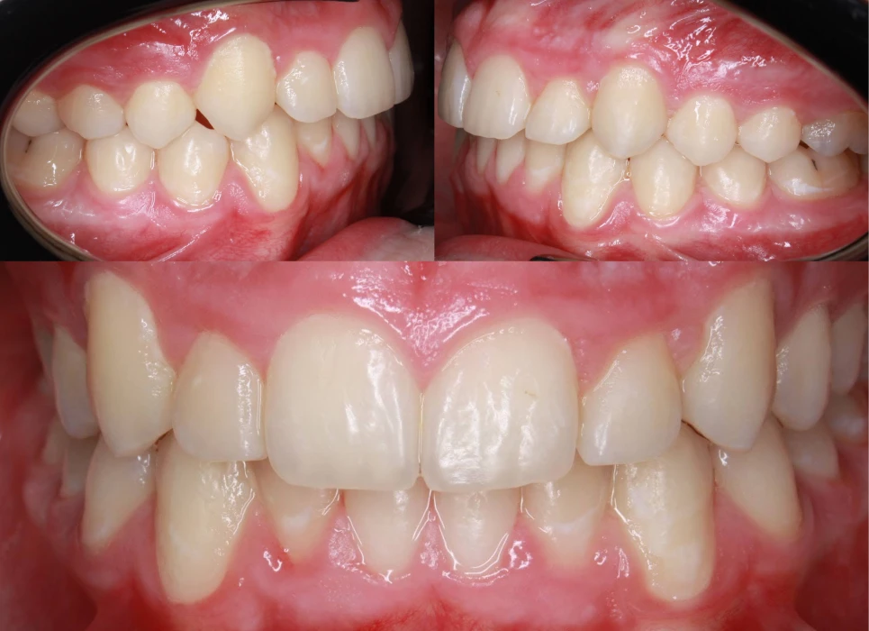 After image