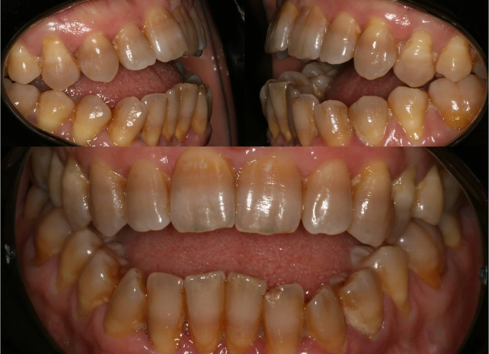 Before image