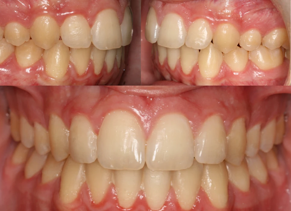 After image