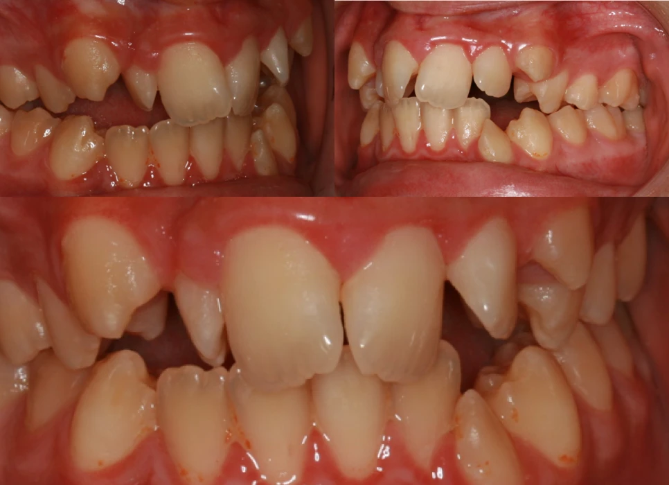 Before image