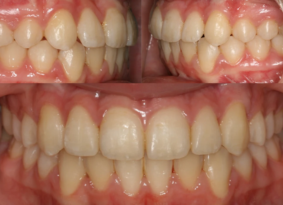 After image