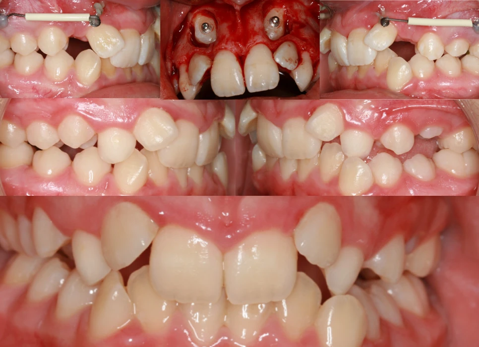 Before image