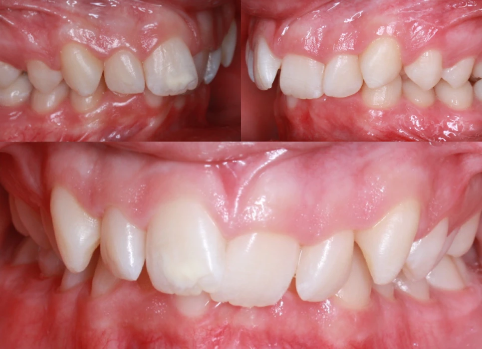 Before image