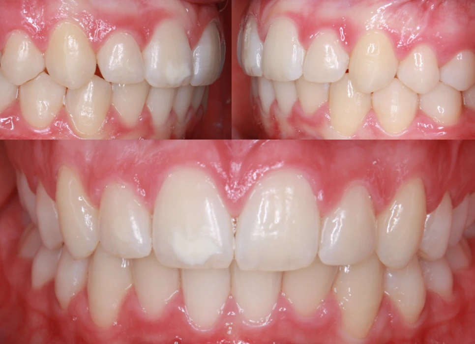 After image
