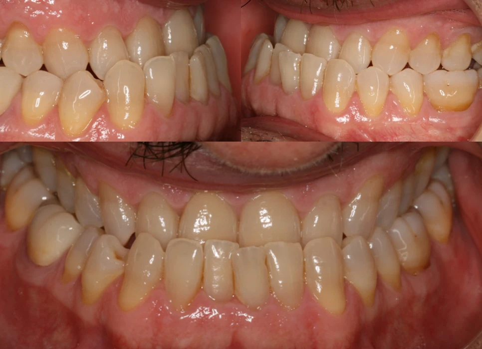 Before image