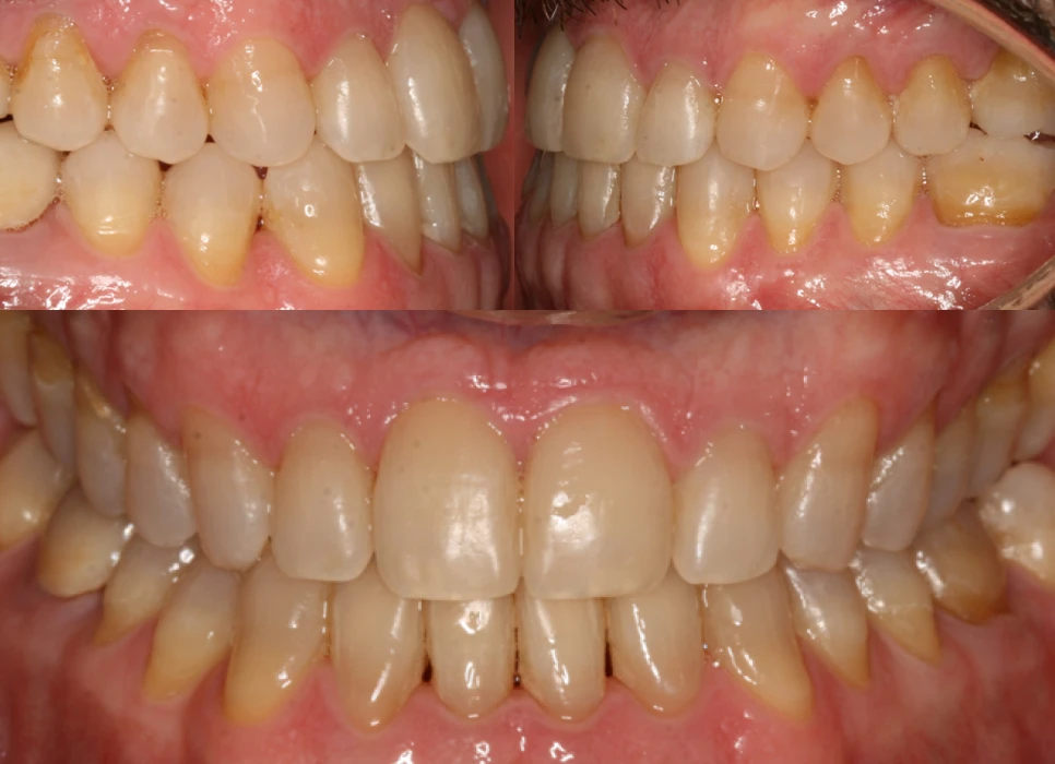 After image