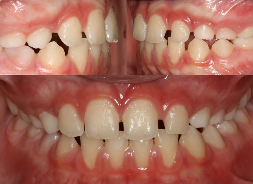 After image