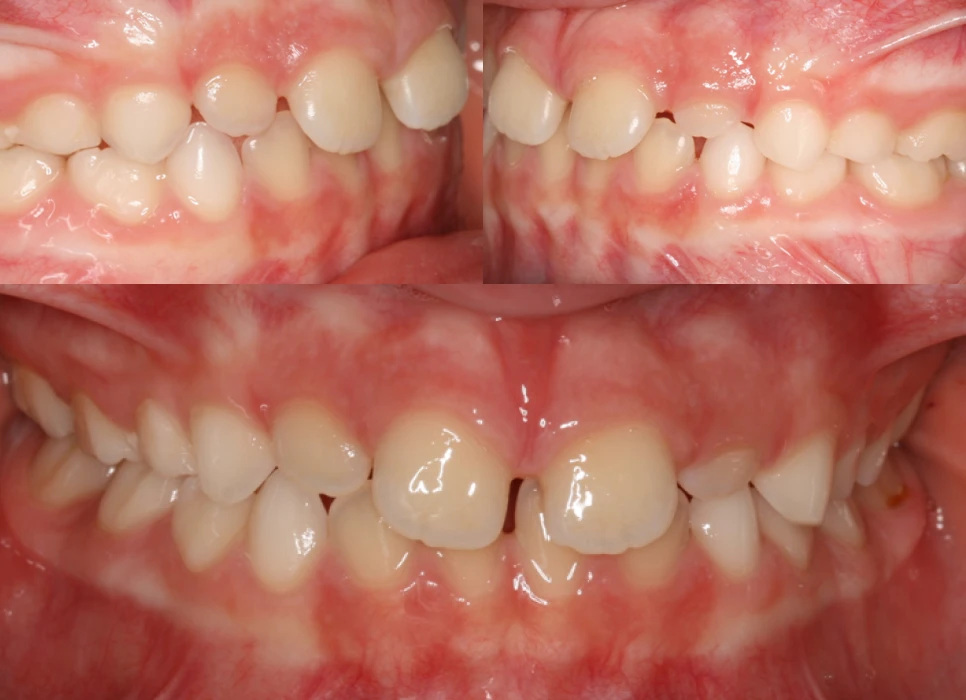 After image