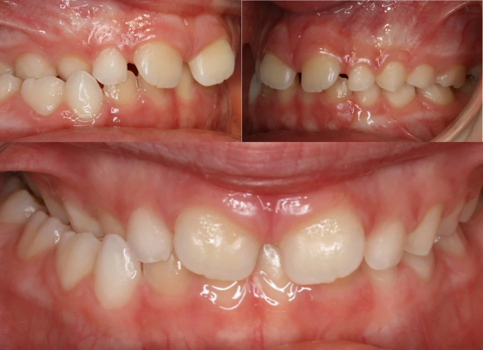 Before image